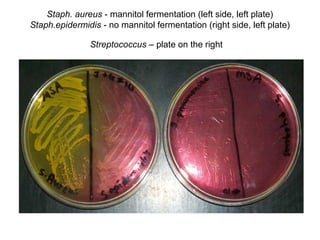 Staph. aureus - mannitol fermentation (left side, left plate)
Staph.epidermidis - no mannitol fermentation (right side, left plate)
Streptococcus – plate on the right
 