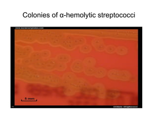 Colonies of α-hemolytic streptococci
 