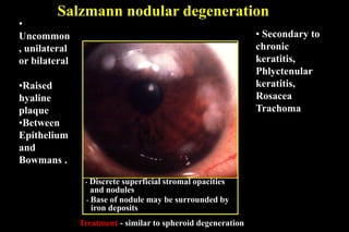 Salzmann nodular degeneration
•
Uncommon
, unilateral
or bilateral
•Raised
hyaline
plaque
•Between
Epithelium
and
Bowmans .
• Secondary to
chronic
keratitis,
Phlyctenular
keratitis,
Rosacea
Trachoma
• Discrete superficial stromal opacities
and nodules
• Base of nodule may be surrounded by
iron deposits
Treatment - similar to spheroid degeneration
 