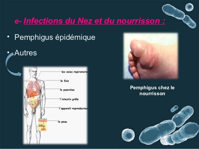 Le traitement des boutons sur la personne de la crème
