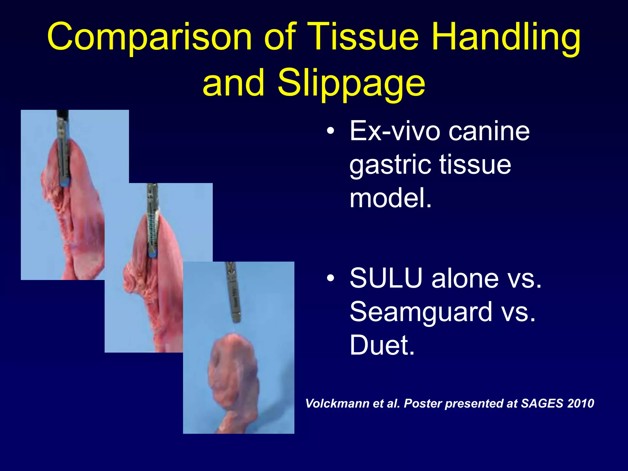 Comparison of Tissue Handling and SlippageEx-vivo canine gastric tissue model.SULU alone vs. Seamguard vs. Duet.Volckmann et al. Poster presented at SAGES 2010