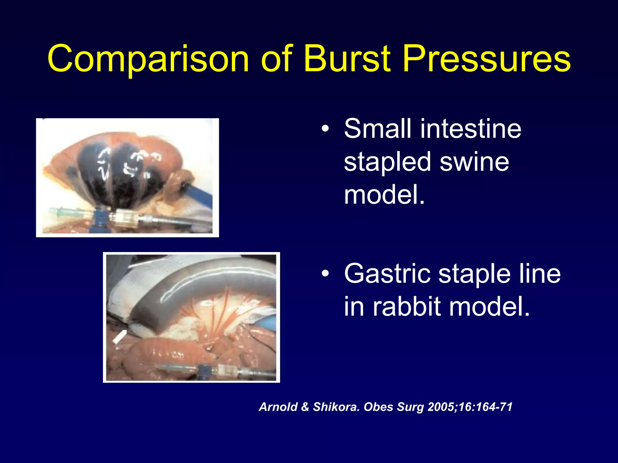 Comparison of Burst PressuresSmall intestine stapled swine model.Gastric staple line in rabbit model.Arnold & Shikora. ObesSurg 2005;16:164-71