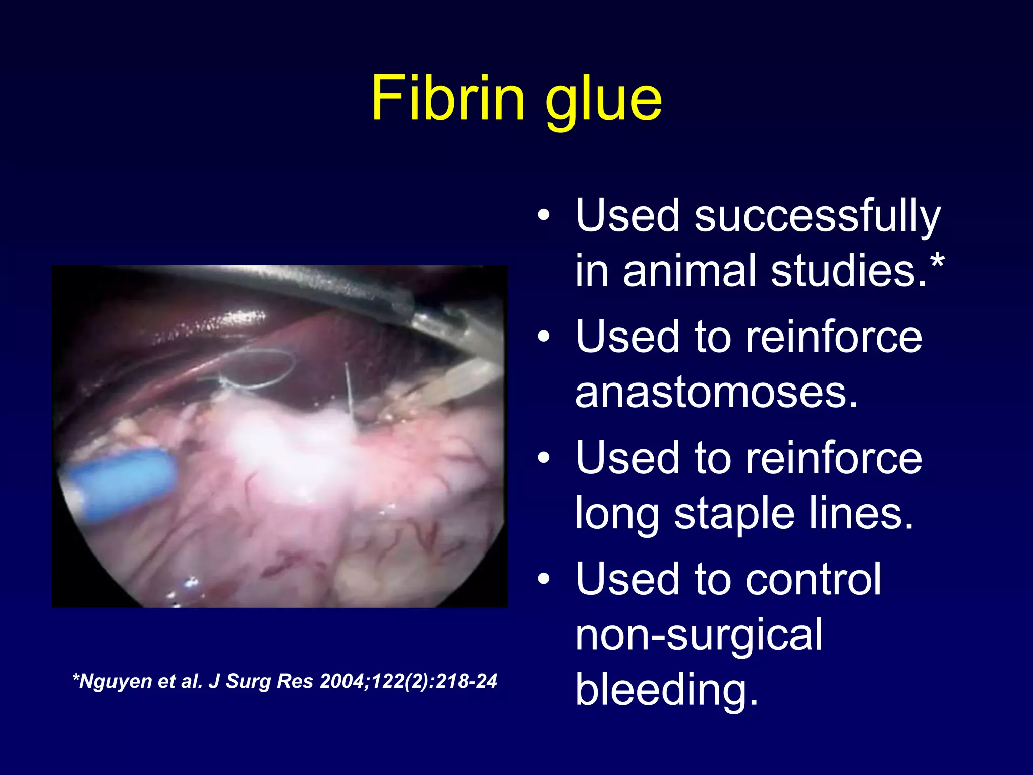 Fibrin glueUsed successfully in animal studies.*Used to reinforce anastomoses.Used to reinforce long staple lines.Used to control non-surgical bleeding.*Nguyen et al. J Surg Res 2004;122(2):218-24