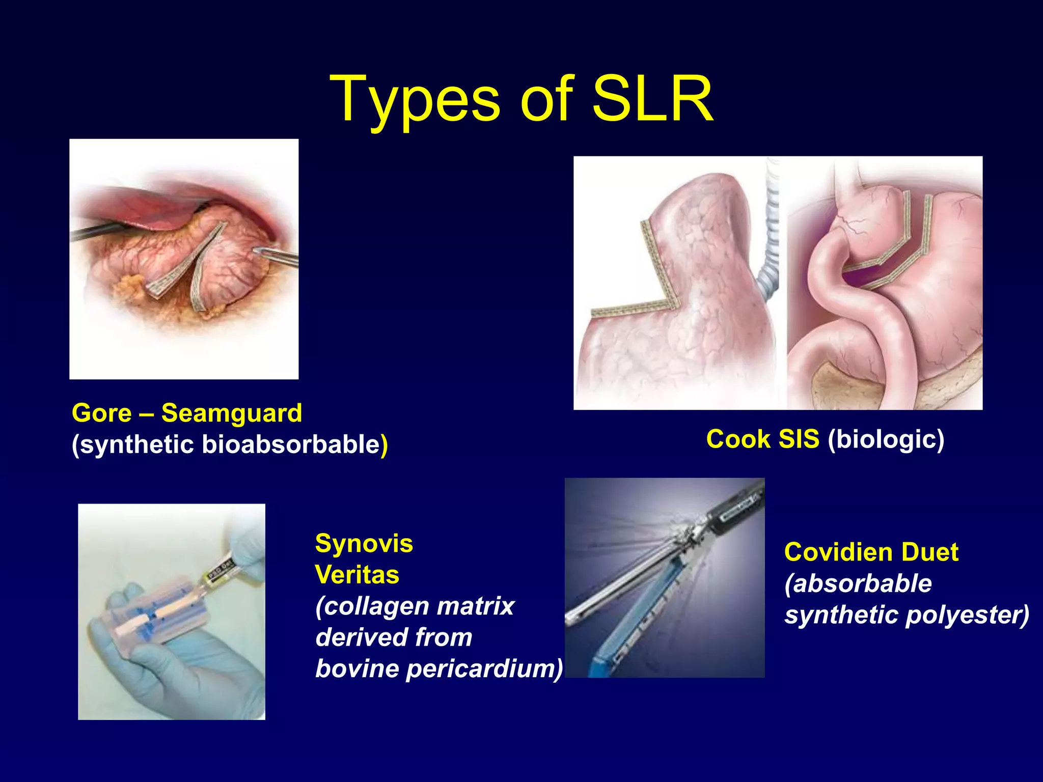 Types of SLRGore – Seamguard(synthetic bioabsorbable)Cook SIS (biologic)SynovisVeritas(collagen matrix derived frombovine pericardium)Covidien Duet(absorbablesynthetic polyester)