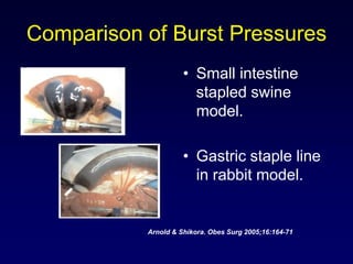 Staple line reinforcement | PPT