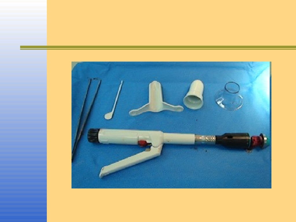 Stapler hemorrhoidectomy 3