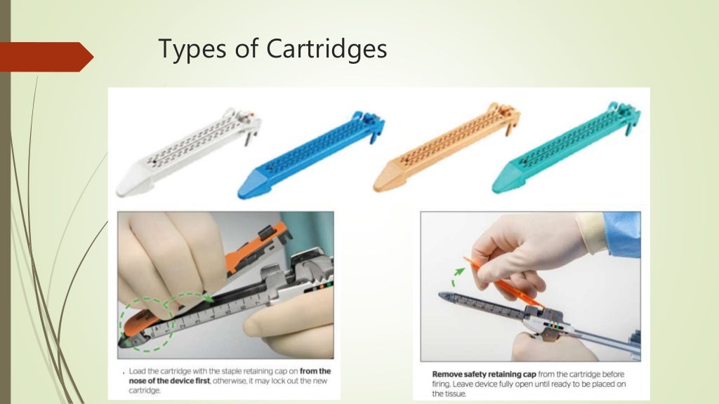 Use of Staplers in surgery