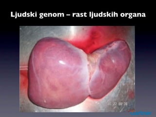 Ljudski genom – rast ljudskih organa
 