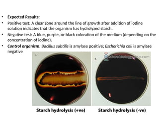 • Expected Results:
• Positive test: A clear zone around the line of growth after addition of iodine
solution indicates that the organism has hydrolyzed starch.
• Negative test: A blue, purple, or black coloration of the medium (depending on the
concentration of iodine).
• Control organism: Bacillus subtilis is amylase positive; Escherichia coli is amylase
negative
 