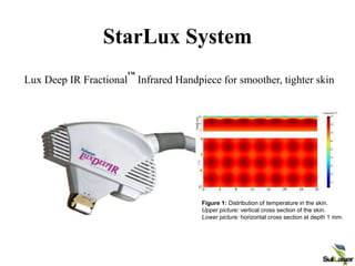 StarLux System
Lux Deep IR Fractional
™
Infrared Handpiece for smoother, tighter skin
Figure 1: Distribution of temperature in the skin.
Upper picture: vertical cross section of the skin.
Lower picture: horizontal cross section at depth 1 mm.
 
