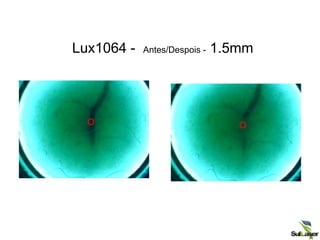 Lux1064 - Antes/Despois - 1.5mm
 