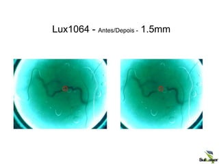 Lux1064 - Antes/Depois - 1.5mm
 