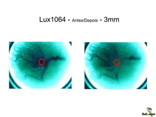 Lux1064 - Antes/Depois - 3mm
 