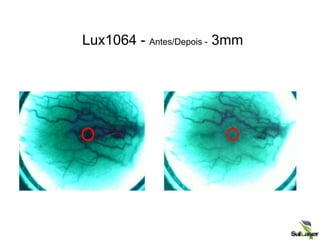 Lux1064 - Antes/Depois - 3mm
 