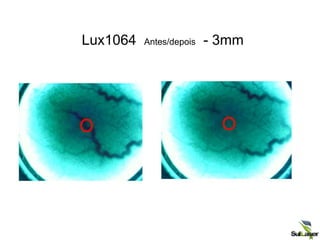 Lux1064 Antes/depois - 3mm
 
