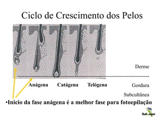 Ciclo de Crescimento dos Pelos
Derme
----------------------------------------------------------------------------
Gordura
Subcultânea
Anágena Catágena Telógena
•Inicio da fase anágena é a melhor fase para fotoepilação
 