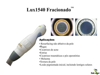 Lux1540 Fracionado
™
Aplicações
• Resurfacing não ablativo da pele
•Rugas
•Cicatrizes de acne
•Estrias
•Cicatrizes traumáticas e pós operatórias
• Melasma
•Textura da pele
•Lesão pigmentada inicial, incluindo lentigos solares
 