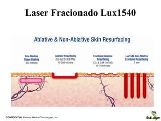 .
Laser Fracionado Lux1540
CONFIDENTIAL Palomar Medical Technologies, Inc.
 