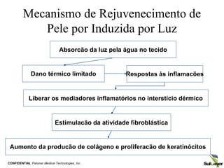 Mecanismo de Rejuvenecimento de
Pele por Induzida por Luz
Absorcão da luz pela água no tecido
Respostas às inflamacões
Liberar os mediadores inflamatórios no interstício dérmico
Estimulacão da atividade fibroblástica
Aumento da producão de colágeno e proliferacão de keratinócitos
Dano térmico limitado
CONFIDENTIAL Palomar Medical Technologies, Inc.
 