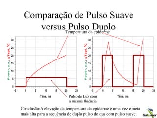Comparação de Pulso Suave
versus Pulso Duplo
0
5
10
15
20
25
30
-5 0 5 10 15 20 25
Time, ms
Power,
a.u
.;
D
Tepi,
0
C
0
5
10
15
20
25
30
-5 0 5 10 15 20 25
Time, ms
Power,
a.u
.;
D
Tepi,
0
C
Temperatura da epiderme
Pulso de Luz com
a mesma fluência
Conclusão:A elevação da temperatura da epiderme é uma vez e meia
mais alta para a sequência de duplo pulso do que com pulso suave.
 
