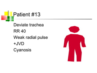Patient #13
Deviate trachea
RR 40
Weak radial pulse
+JVD
Cyanosis
 