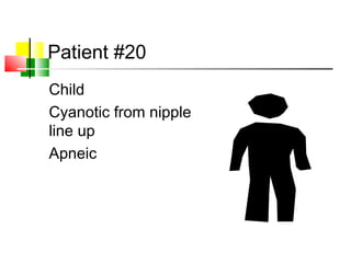 Patient #20
Child
Cyanotic from nipple
line up
Apneic
 