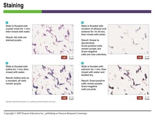 Staining [INSERT FIGURE 4.17] 