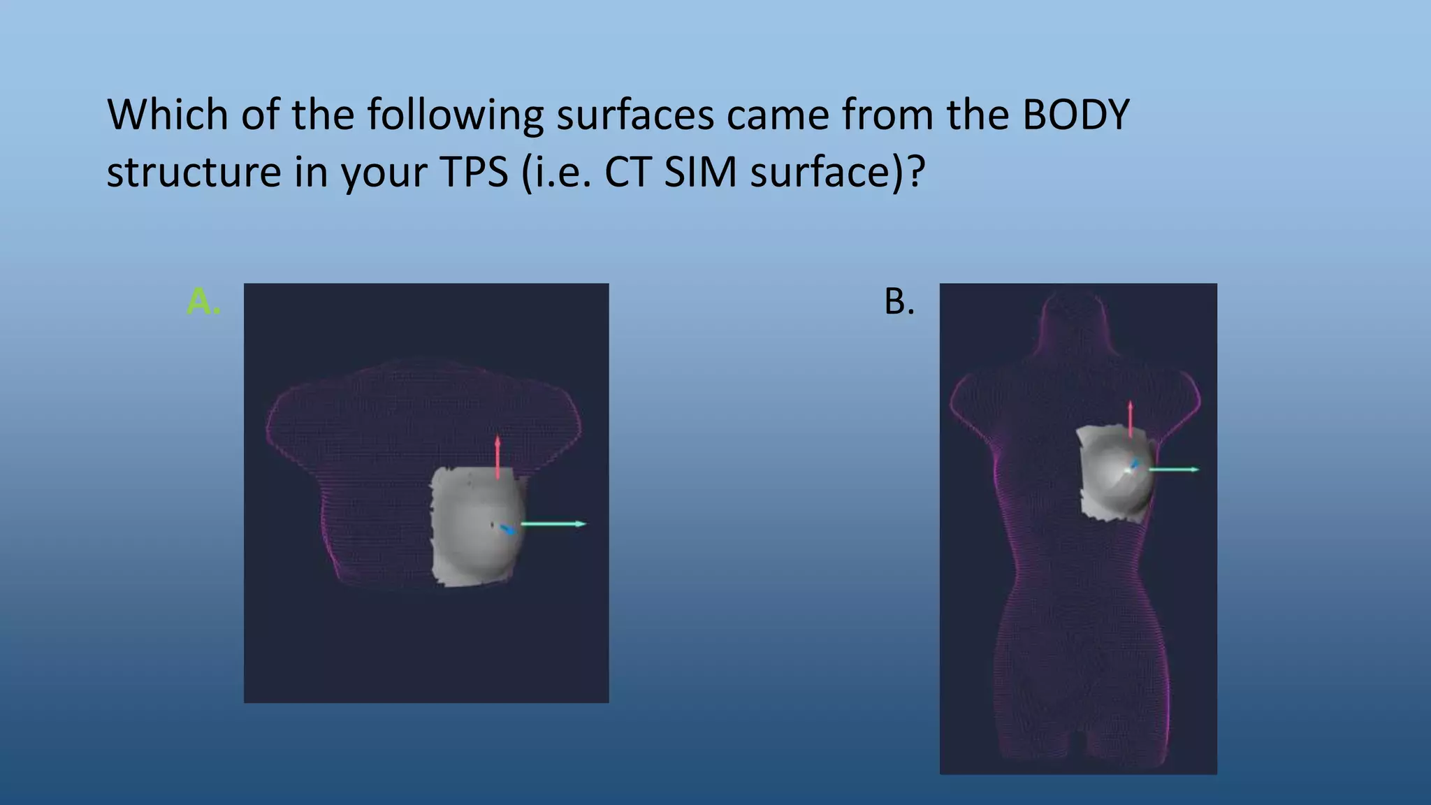 Which of the following surfaces came from the BODY
structure in your TPS (i.e. CT SIM surface)?
A. B.
 