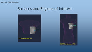 Surfaces and Regions of Interest
Section I: DIBH Workflow
CT Surface and ROI
SGRT Surface and ROI
 