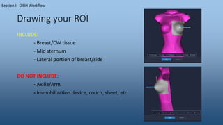 Drawing your ROI
Section I: DIBH Workflow
INCLUDE:
- Breast/CW tissue
- Mid sternum
- Lateral portion of breast/side
DO NOT INCLUDE:
- Axilla/Arm
- Immobilization device, couch, sheet, etc.
 