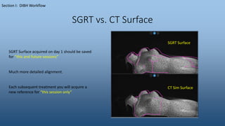 SGRT vs. CT Surface
Section I: DIBH Workflow
SGRT Surface acquired on day 1 should be saved
for “this and future sessions”
Much more detailed alignment.
Each subsequent treatment you will acquire a
new reference for “this session only”
SGRT Surface
CT Sim Surface
 