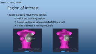 Region of Interest
• Issues that could result from poor ROI:
1. Deltas are oscillating rapidly
2. Loss of tracking signal completely (ROI too small)
3. Setup to surface is non-reproducible
Section II: Lessons Learned
 