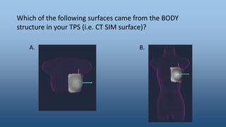 Which of the following surfaces came from the BODY
structure in your TPS (i.e. CT SIM surface)?
A. B.
 
