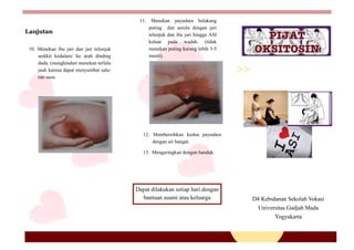 10. Menekan ibu jari dan jari telunjuk
sedikit kedalam/ ke arah dinding
dada. (menghindari menekan terlalu
jauh karena dapat menyumbat salu-
ran susu.
Lanjutan
11. Menekan payudara belakang
puting dan aerola dengan jari
telunjuk dan ibu jari hingga ASI
keluar pada wadah. (tidak
menekan puting kurang lebih 3-5
menit).
12. Membersihkan kedua payudara
dengan air hangat.
13. Mengeringkan dengan handuk.
Dapat dilakukan setiap hari dengan
bantuan suami atau keluarga D4 Kebidanan Sekolah Vokasi
Universitas Gadjah Mada
Yogyakarta
 