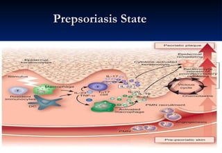 Prepsoriasis State 
