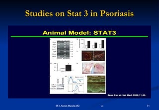Studies on Stat 3 in Psoriasis 