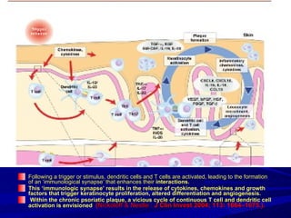 Following a trigger or stimulus, dendritic cells and T cells are activated, leading to the formation of an ‘immunological synapse’ that enhances their  interactions.  This ‘immunologic synapse’ results in the release of cytokines, chemokines and growth factors that trigger keratinocyte proliferation, altered differentiation and angiogenesis. Within the chronic psoriatic plaque, a vicious cycle of continuous T cell and dendritic cell activation is envisioned   ( Nickoloff & Nestle :  J Clin Invest 2004; 113: 1664–1675.).   