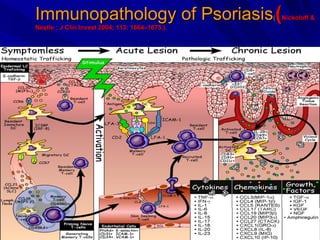 Immunopathology of Psoriasis ( ( Nickoloff & Nestle : J Clin Invest 2004; 113: 1664–1675.).   