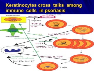 Keratinocytes cross  talks  among immune  cells   in psoriasis 