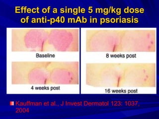 Effect of a single 5 mg/kg dose of anti-p40 mAb in psoriasis Kauffman et al., J Invest Dermatol 123: 1037, 2004 