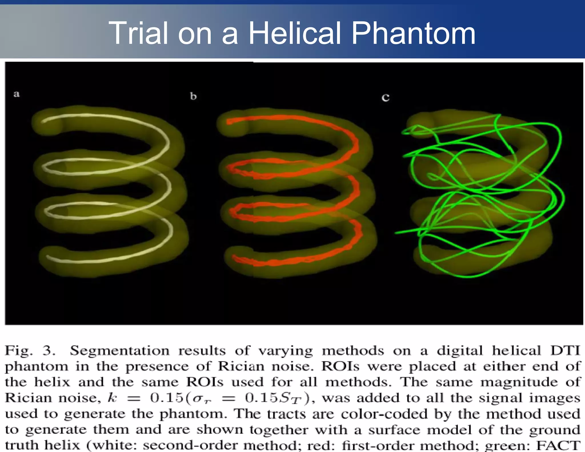 Trial on a Helical Phantom
 