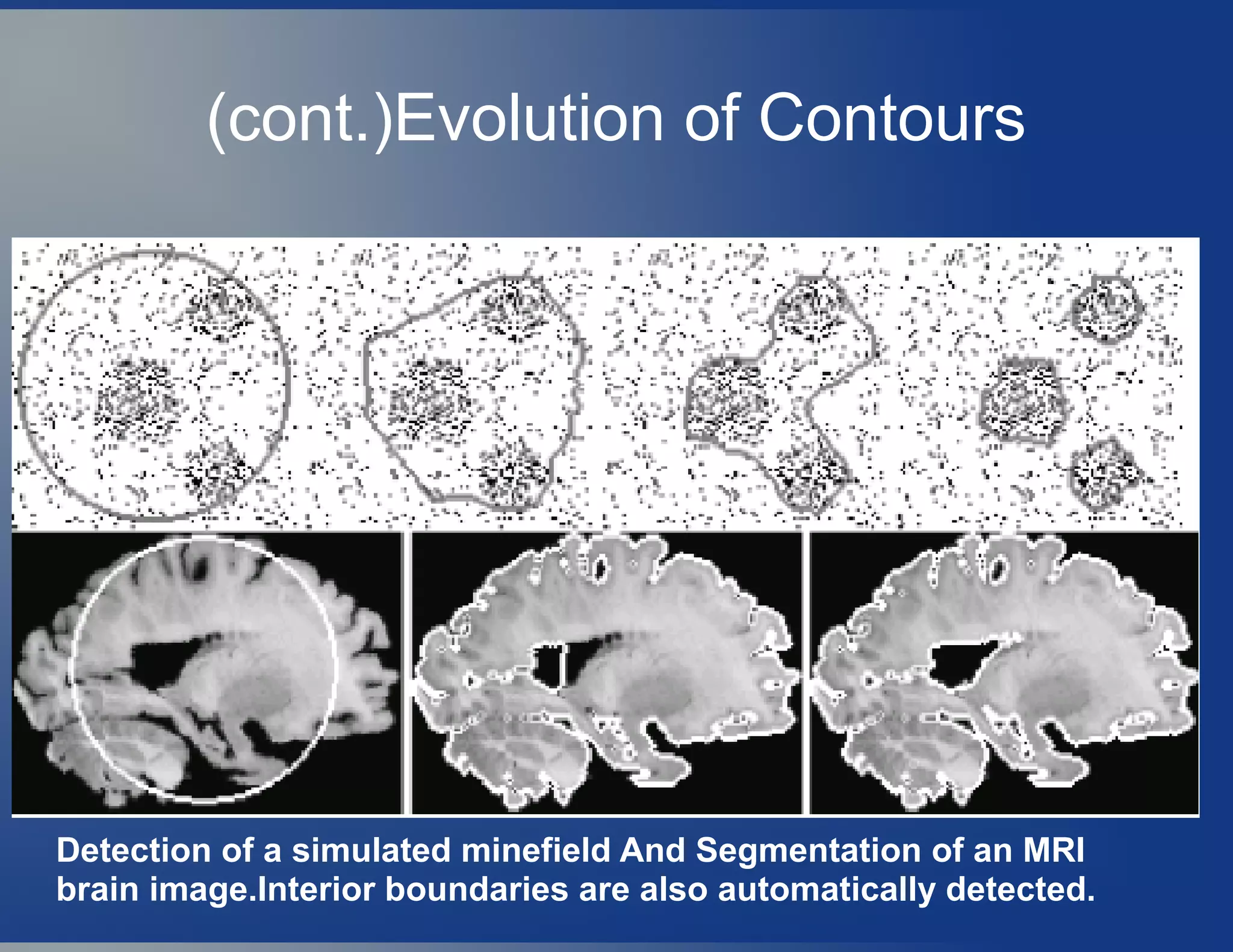 Detection of a simulated minefield And Segmentation of an MRI
brain image.Interior boundaries are also automatically detected.
(cont.)Evolution of Contours
 