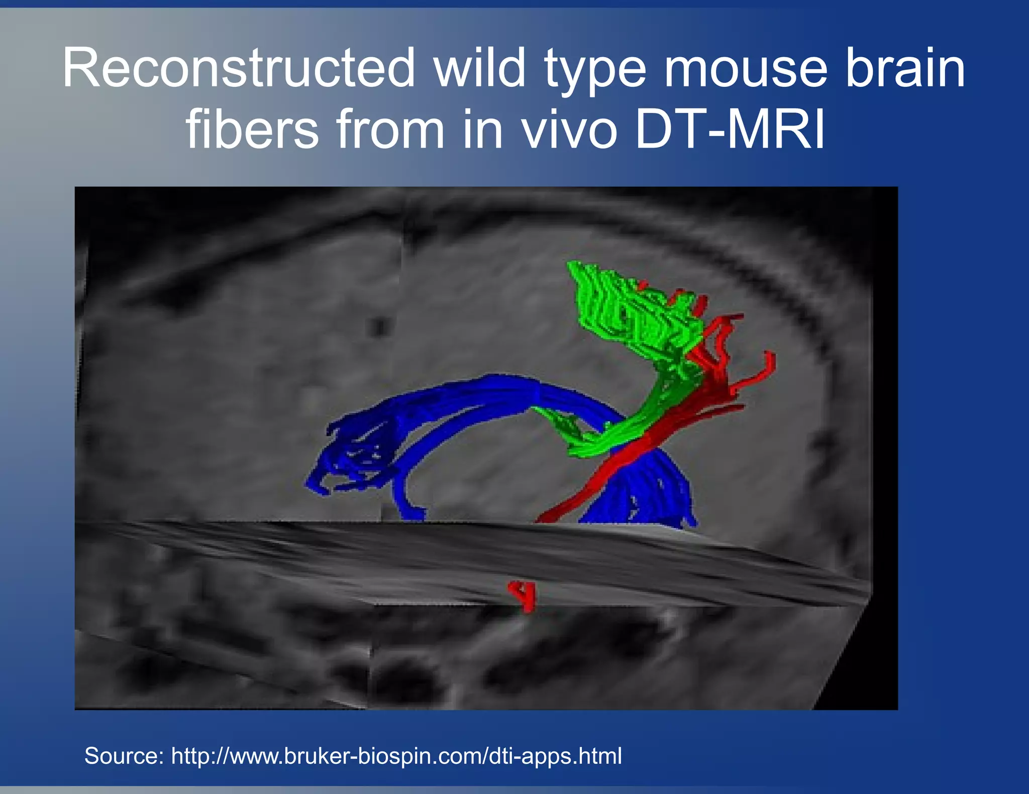 Reconstructed wild type mouse brain
fibers from in vivo DT-MRI
Source: http://www.bruker-biospin.com/dti-apps.html
 