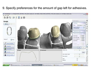 9. Specify preferences for the amount of gap left for adhesives.
 