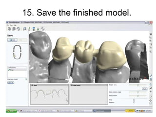 State of the art dental specific software