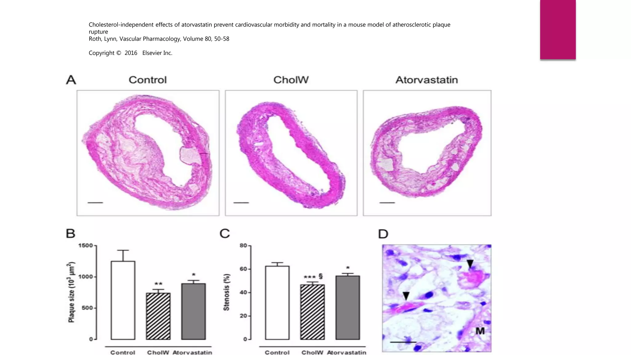 Cholesterol-independent effects of atorvastatin prevent cardiovascular morbidity and mortality in a mouse model of atherosclerotic plaque
rupture
Roth, Lynn, Vascular Pharmacology, Volume 80, 50-58
Copyright © 2016 Elsevier Inc.
 