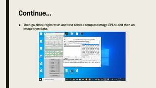 Statistical parametric mapping | PPTX