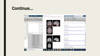Statistical parametric mapping | PPTX