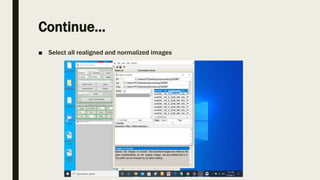 Statistical parametric mapping | PPTX
