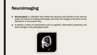 Statistical parametric mapping | PPTX